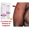 Creme anti-vergeture Hydratant d'élimination des cicatrices de grossesse - Ingrédients naturels - 80g